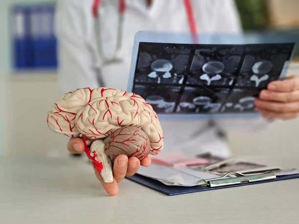 neuropediatras