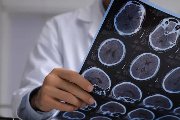 neuropediatras