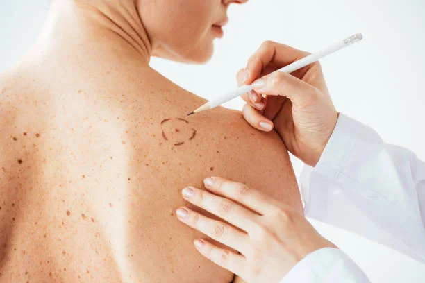 dermatologista